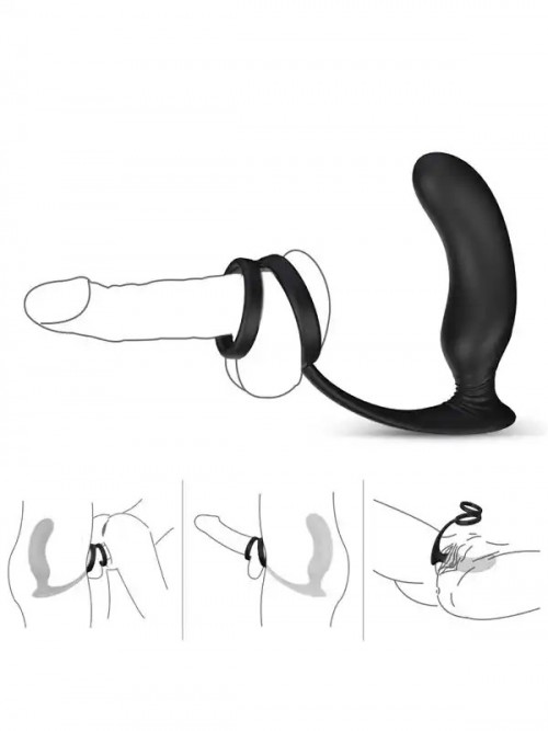 NOXXX Halo Prostat ve Penis Halkalı Şarjlı Anal Masaj Vibratörü 5