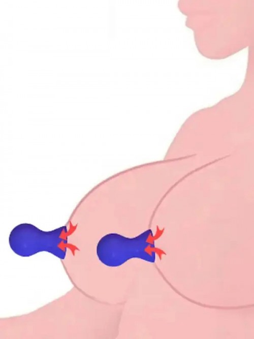 NOXXX Nipple Suckers Göğüc Ucu ve Klitoris Pompası Mor 3